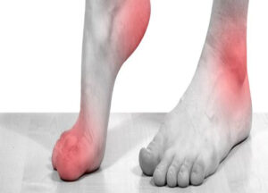 There are all different types of Toe Pain – Foot Houston