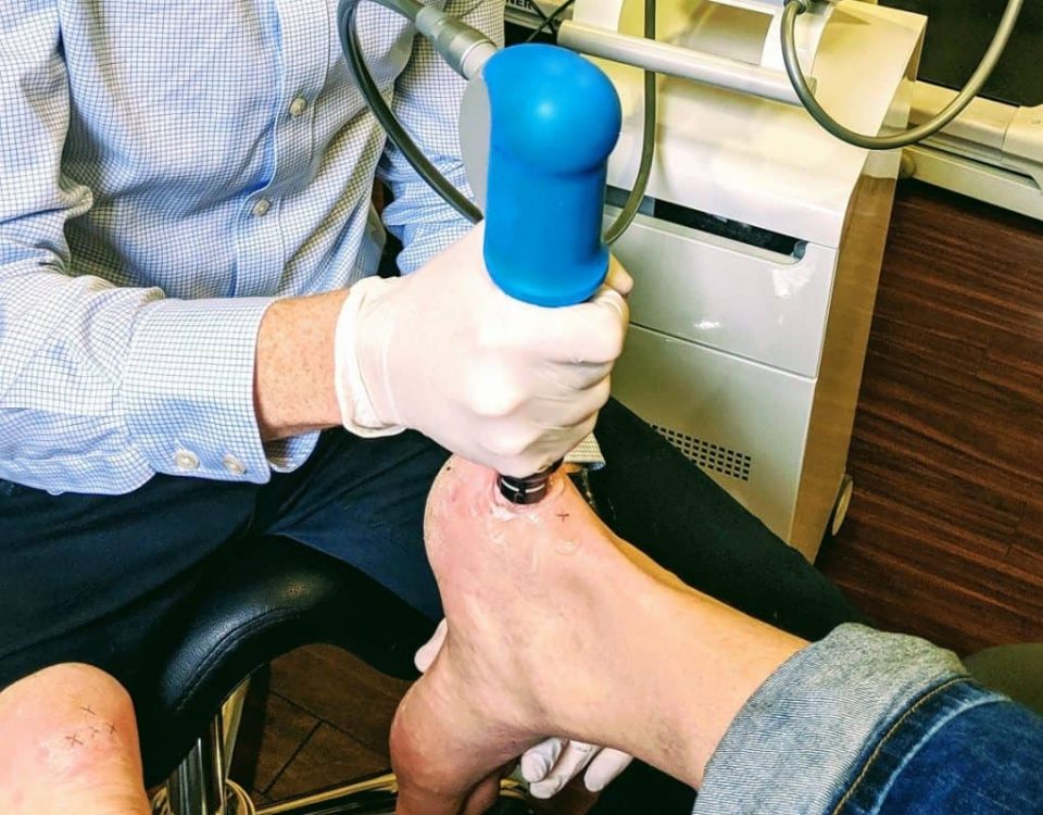 Shockwave Therapy for Relieving Foot and Heel Pain