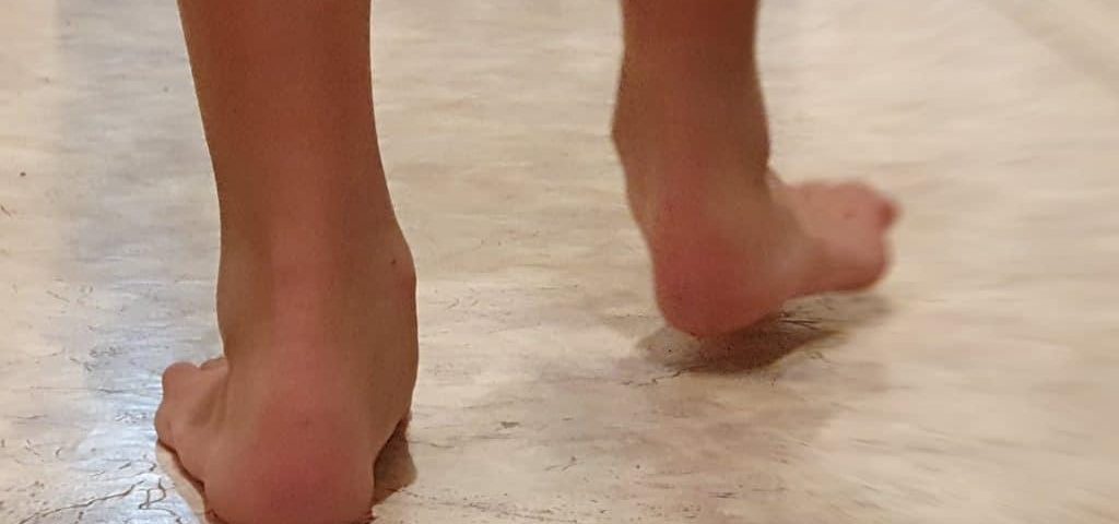 Flat Feet in Kids