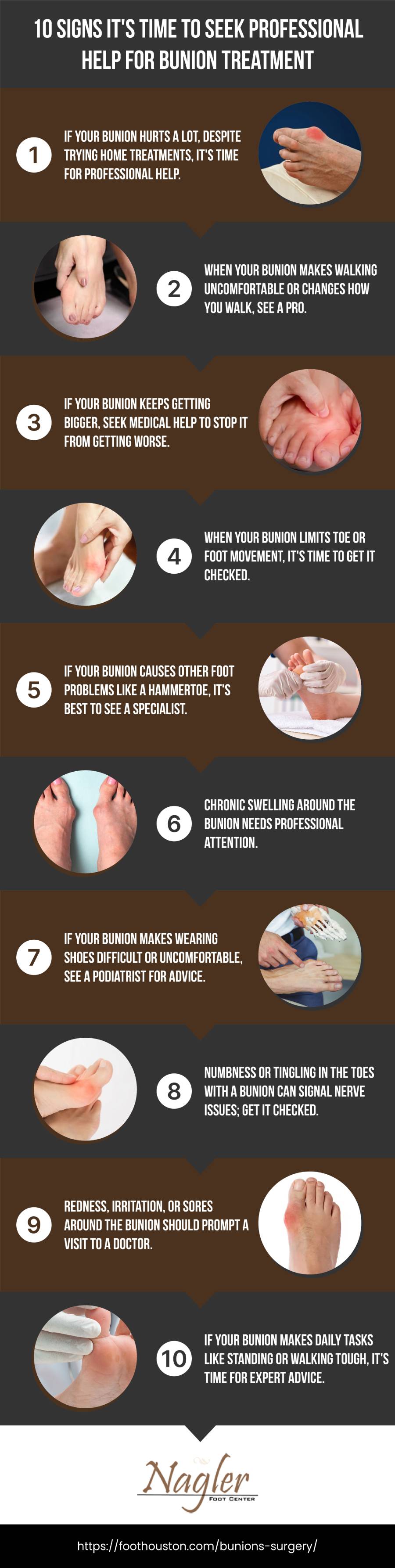 10 Signs It's Time to Seek Professional Help for Bunion Treatment