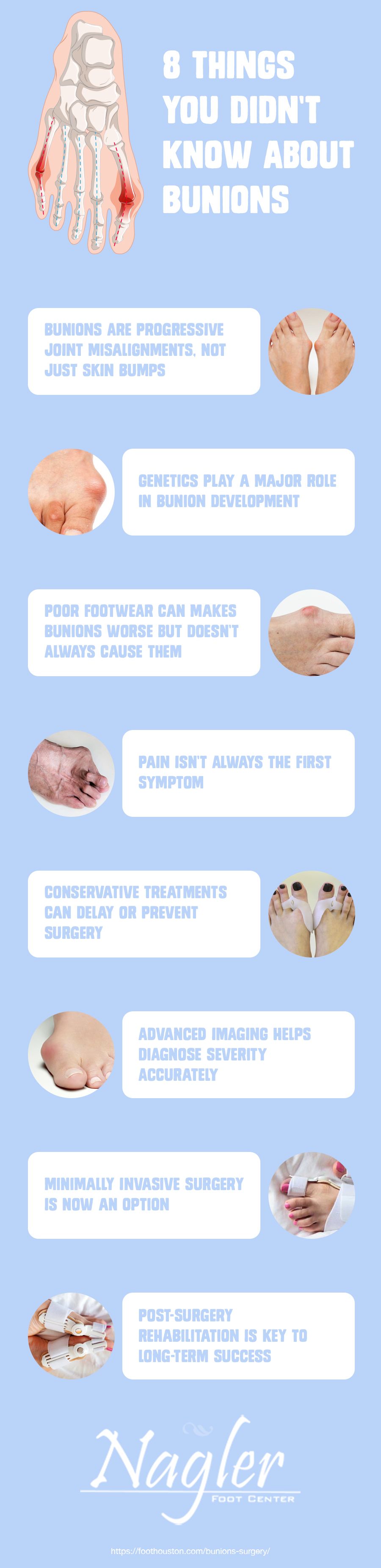 8 Things You Didn’t Know About Bunions