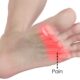 Understanding and Preventing Common Foot Injuries