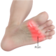 Pain in the ball of the foot