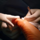 Unique incision surgery Houston
