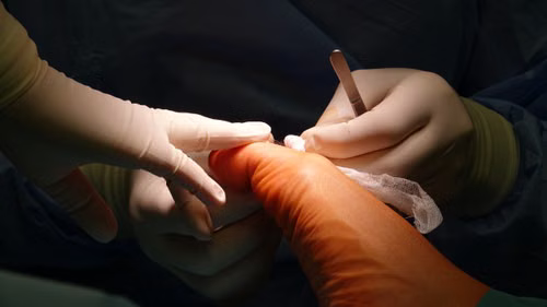 Unique incision surgery Houston