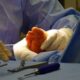 Bunions treatment in Houston