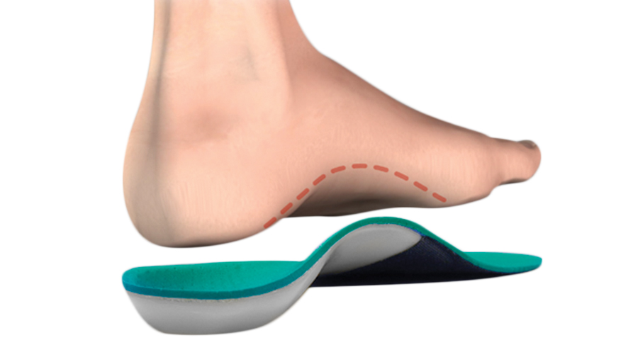 Custom orthotics