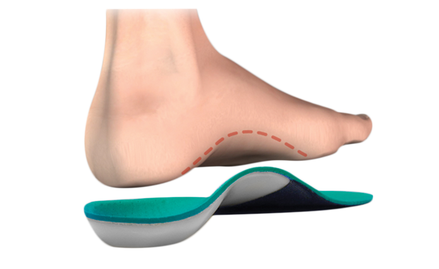 Custom orthotics